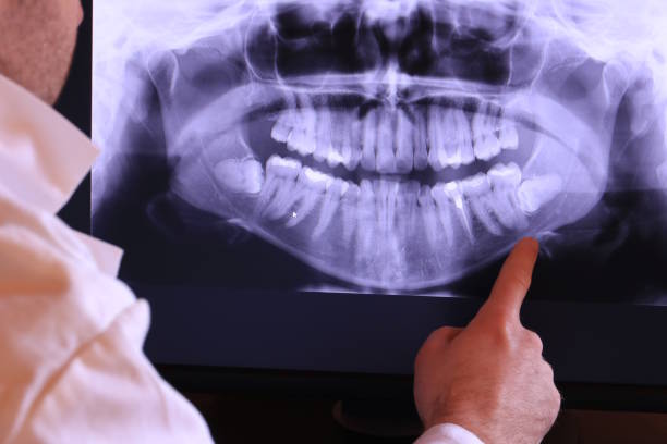 Best Lost Filling or Crown Replacement in Centrevle, IL
