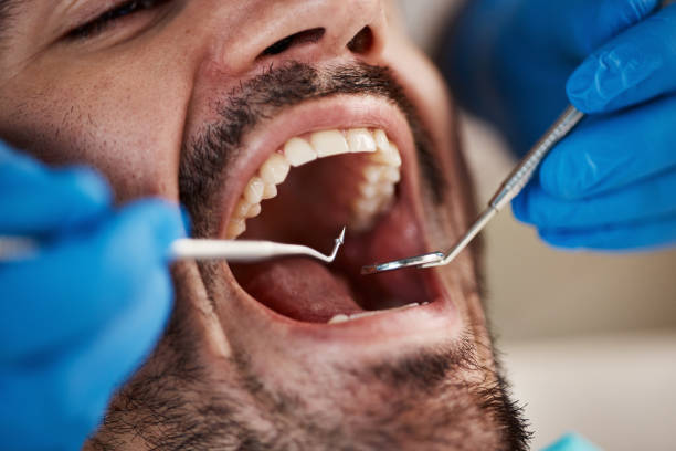 Best Walk-In Emergency Dental Services in Centrevle, IL