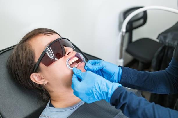 Best Emergency Wisdom Tooth Extraction in Centrevle, IL